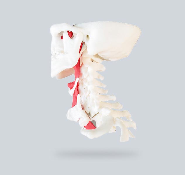 3d-printed-model-of-patients-spine-and-windpipe